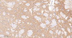 mGluR5 Antibody in Immunohistochemistry (Paraffin) (IHC (P))