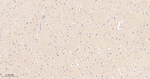 mGluR5 Recombinant Rabbit Monoclonal Antibody (11B6)