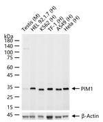 PIM1 Recombinant Rabbit Monoclonal Antibody (4E19)