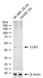 CCR3 Recombinant Rabbit Monoclonal Antibody (12F9)