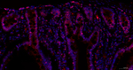 Lamin B Receptor Antibody in Immunohistochemistry (Paraffin) (IHC (P))