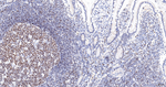Lamin B Receptor Antibody in Immunohistochemistry (Paraffin) (IHC (P))