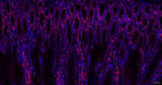 Lamin B Receptor Antibody in Immunohistochemistry (Paraffin) (IHC (P))