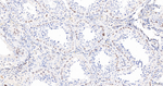 Lamin B Receptor Antibody in Immunohistochemistry (Paraffin) (IHC (P))