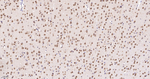 UBC9 Antibody in Immunohistochemistry (Paraffin) (IHC (P))