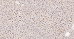 UBC9 Antibody in Immunohistochemistry (Paraffin) (IHC (P))