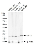 UBC9 Antibody in Western Blot (WB)