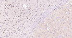 TPH1 Antibody in Immunohistochemistry (Paraffin) (IHC (P))
