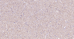 TPH1 Antibody in Immunohistochemistry (Paraffin) (IHC (P))