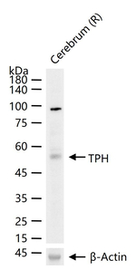 TPH1 Antibody in Western Blot (WB)
