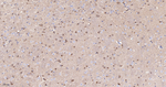 ACACA/ACACB Antibody in Immunohistochemistry (Paraffin) (IHC (P))