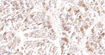 ACACA/ACACB Antibody in Immunohistochemistry (Paraffin) (IHC (P))