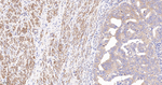 ACACA/ACACB Recombinant Rabbit Monoclonal Antibody (17C5)