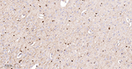 ACACA/ACACB Antibody in Immunohistochemistry (Paraffin) (IHC (P))
