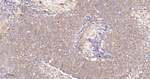 ACACA/ACACB Antibody in Immunohistochemistry (Paraffin) (IHC (P))