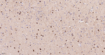 ACACA/ACACB Antibody in Immunohistochemistry (Paraffin) (IHC (P))