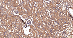ACACA/ACACB Antibody in Immunohistochemistry (Paraffin) (IHC (P))