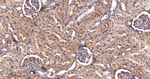 ACACA/ACACB Antibody in Immunohistochemistry (Paraffin) (IHC (P))