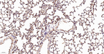 ACACA/ACACB Antibody in Immunohistochemistry (Paraffin) (IHC (P))