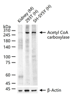 ACACA/ACACB Antibody in Western Blot (WB)
