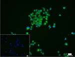 GOLPH2 Recombinant Rabbit Monoclonal Antibody (2B11)