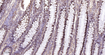 GOLPH2 Antibody in Immunohistochemistry (Paraffin) (IHC (P))