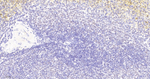 DAXX Antibody in Immunohistochemistry (Paraffin) (IHC (P))