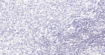 DAXX Recombinant Rabbit Monoclonal Antibody (6G3)