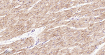 Dysferlin Antibody in Immunohistochemistry (Paraffin) (IHC (P))