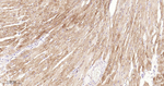 Dysferlin Antibody in Immunohistochemistry (Paraffin) (IHC (P))