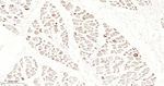 Dysferlin Antibody in Immunohistochemistry (Paraffin) (IHC (P))