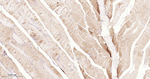 Dysferlin Recombinant Rabbit Monoclonal Antibody (12B8)
