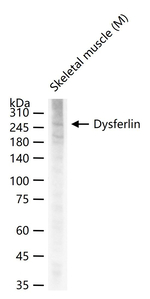 Dysferlin Antibody in Western Blot (WB)
