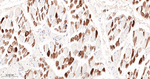 SERCA1 ATPase Recombinant Rabbit Monoclonal Antibody (9H2)