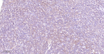 MST2 Recombinant Rabbit Monoclonal Antibody (14D11)