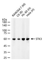 MST2 Antibody in Western Blot (WB)