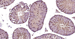 PEBP1 Antibody in Immunohistochemistry (Paraffin) (IHC (P))