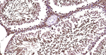 PEBP1 Antibody in Immunohistochemistry (Paraffin) (IHC (P))