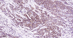 PEBP1 Antibody in Immunohistochemistry (Paraffin) (IHC (P))