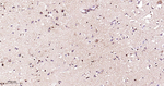 PEBP1 Antibody in Immunohistochemistry (Paraffin) (IHC (P))