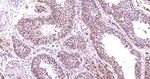 PEBP1 Antibody in Immunohistochemistry (Paraffin) (IHC (P))