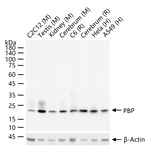 PEBP1 Antibody in Western Blot (WB)