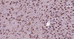 MSI2 Antibody in Immunohistochemistry (Paraffin) (IHC (P))