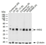 MSI2 Antibody in Western Blot (WB)