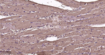 Myoglobin Antibody in Immunohistochemistry (Paraffin) (IHC (P))