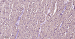 Myoglobin Antibody in Immunohistochemistry (Paraffin) (IHC (P))