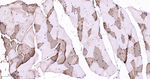 Myoglobin Recombinant Rabbit Monoclonal Antibody (5D14)
