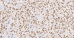 hnRNP K Antibody in Immunohistochemistry (Paraffin) (IHC (P))