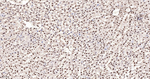 hnRNP K Antibody in Immunohistochemistry (Paraffin) (IHC (P))