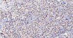 hnRNP K Antibody in Immunohistochemistry (Paraffin) (IHC (P))